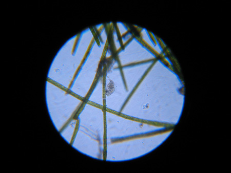 Wasserprobe aus Becken Bernd Lachmann 23.1.2005